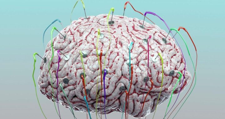Estimulación cerebral: ¿el futuro para mejorar nuestra memoria?