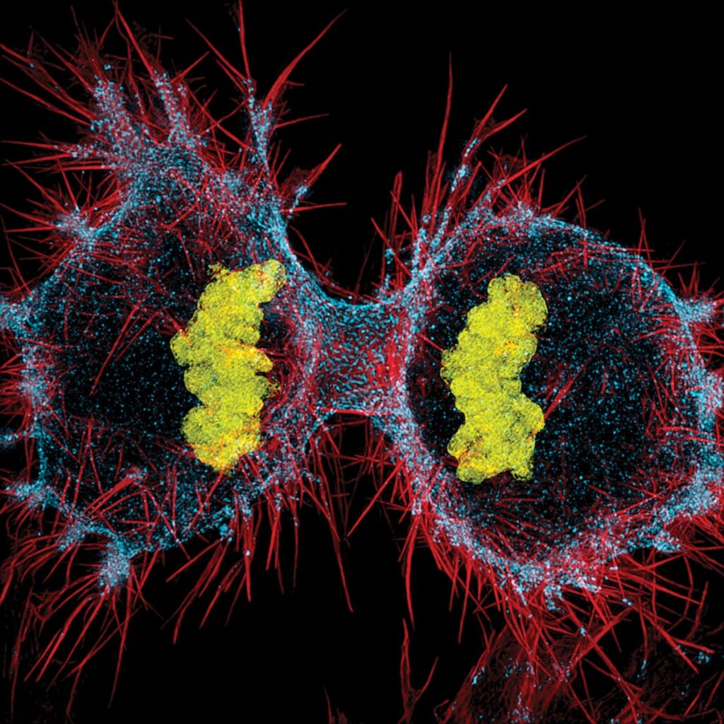 Unos virus primitivos que se propagan por el genoma humano, nuevo motor del cáncer | Salud y bienestar