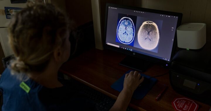 Así es como los científicos pretenden evitar que el alcohol y las drogas secuestren el cerebro | Salud y bienestar