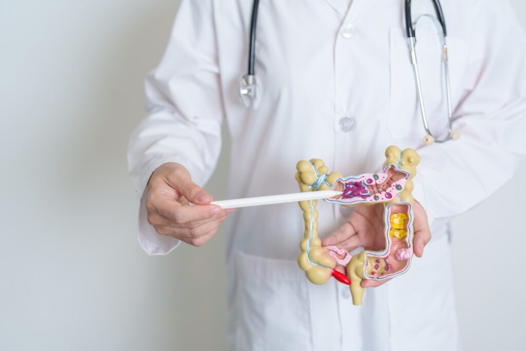 El cáncer colorrectal no es solo cosa de viejos