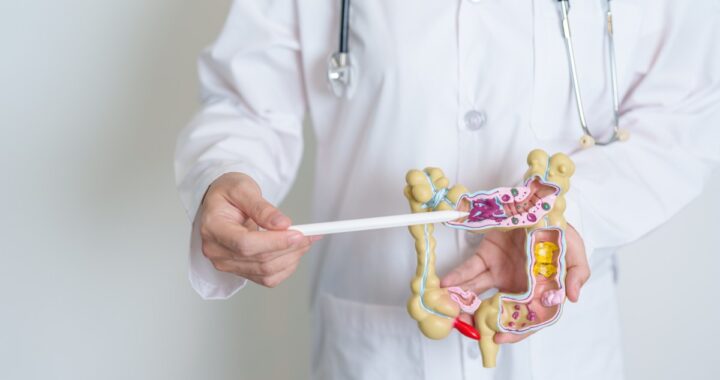 El cáncer colorrectal no es solo cosa de viejos