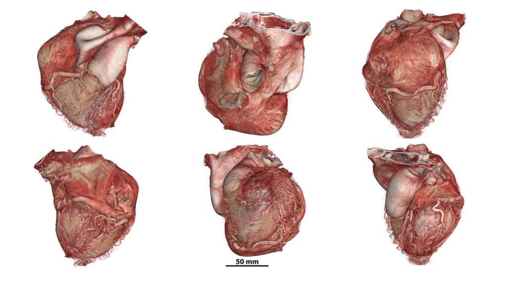 Un nuevo atlas interactivo permite ver el cuerpo humano como nunca antes | Salud y bienestar