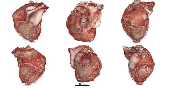 Un nuevo atlas interactivo permite ver el cuerpo humano como nunca antes | Salud y bienestar