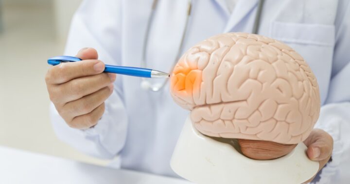 La historia de un joven que sobrevivió a un tumor tras 10 años de diagnósticos erróneos