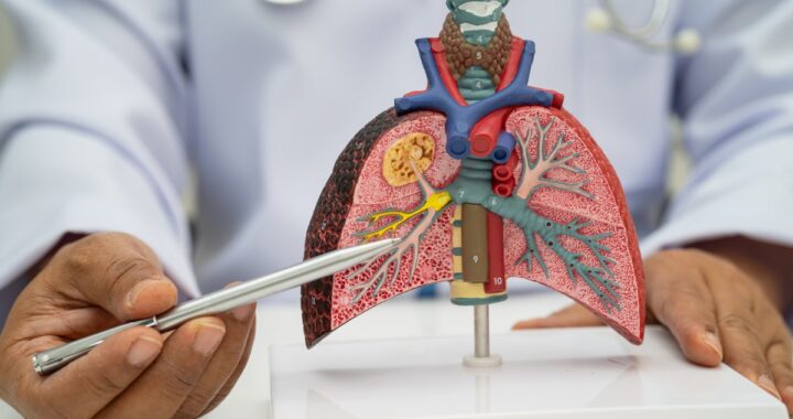Líquido en los pulmones: 4 señales que debes atender de inmediato