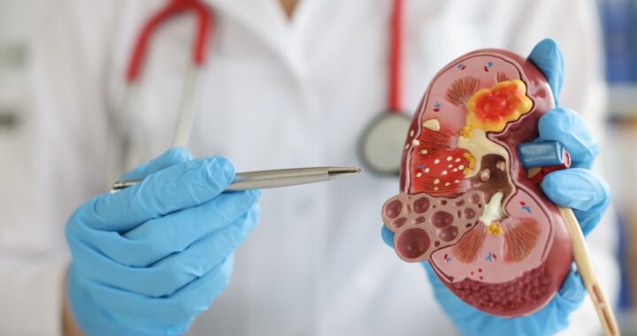 El medicamento que más daña los riñones y lo sigues tomando: advierten médicos