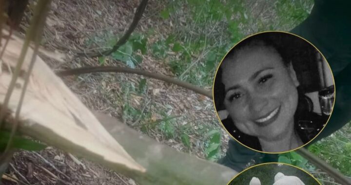 Informe forense con radiografías de fracturas costales y mapa de 11 heridas con arma blanca en caso de violencia extrema