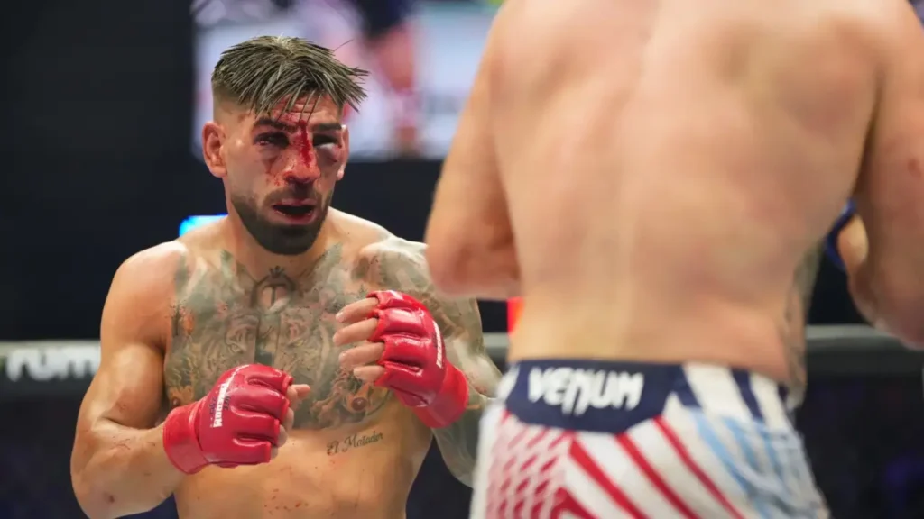 Ilia Topuria con inflamación facial en el UFC tras decir 'no veo casi nada'
