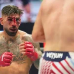 Ilia Topuria con inflamación facial en el UFC tras decir 'no veo casi nada'