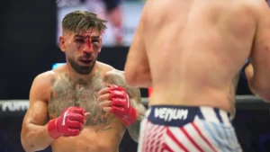 Ilia Topuria con inflamación facial en el UFC tras decir 'no veo casi nada'