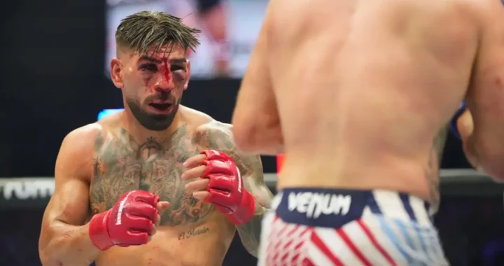 Ilia Topuria con inflamación facial en el UFC tras decir 'no veo casi nada'