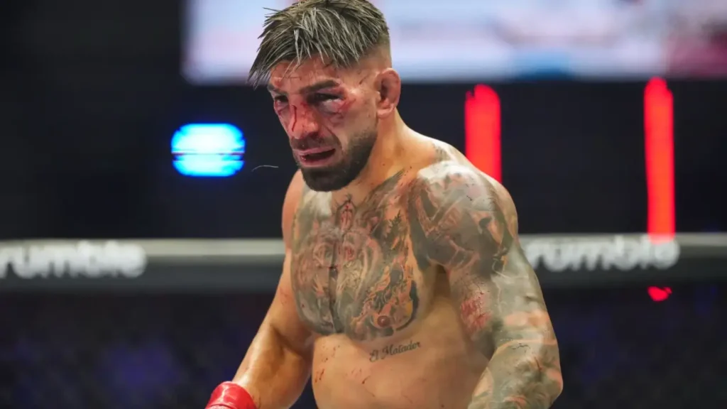 Ilia Topuria en combate contra Justin Gaethje mostrando lesiones tras la pelea