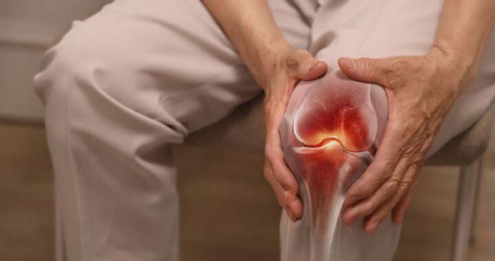 Médico examinando rodilla con enfoque en articulación y líquido sinovial