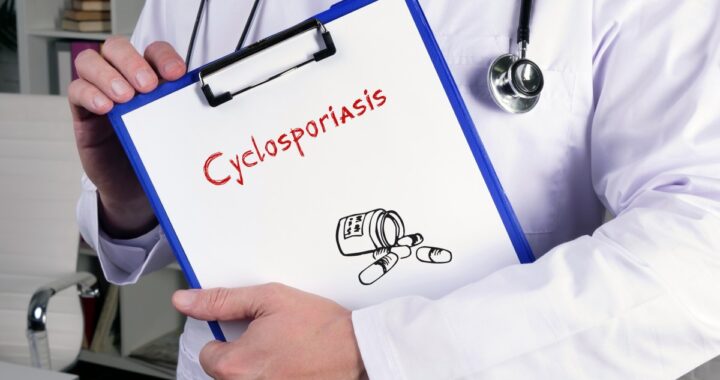 ¿La cyclosporiasis puede ser mortal? Médicos lo aclaran