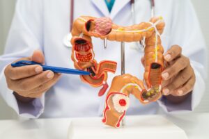 Cáncer de colon: 5 síntomas que se confunden con una colitis