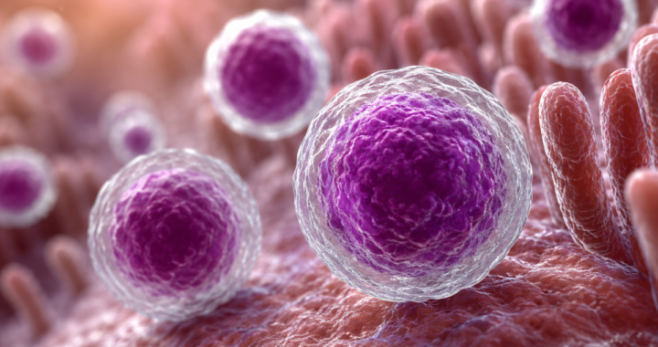 Ciclosporiasis en 32 estados: cuáles son los síntomas y cuándo puede ser grave
